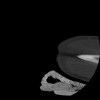SPORK, NICO - 22.03.1976 - 02.08.2022 - CT obere Extremität - 17:51:17